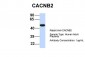 CACNB4 antibody - middle region